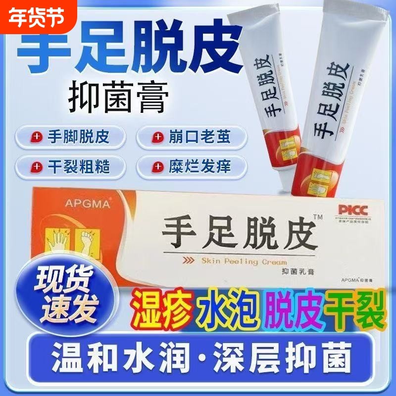 正品手脚脱皮膏手足干裂手痒皮肤干燥水泡止痒粗糙防裂超滋润