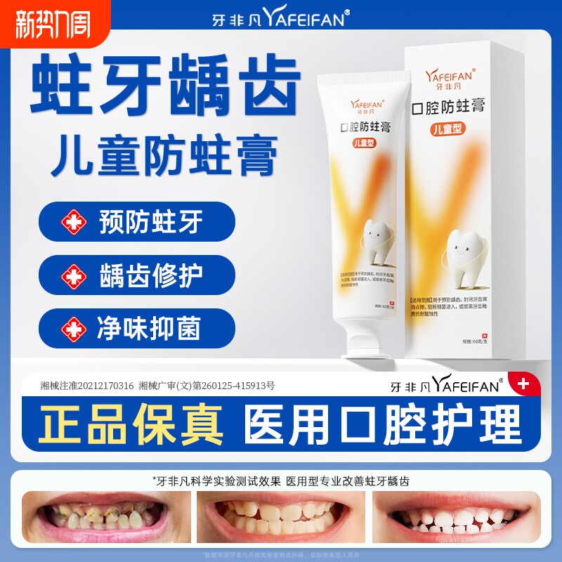 牙非凡儿童口腔防蛀膏防龋齿固齿封闭牙窝沟点隙牙菌斑牙膏s修复