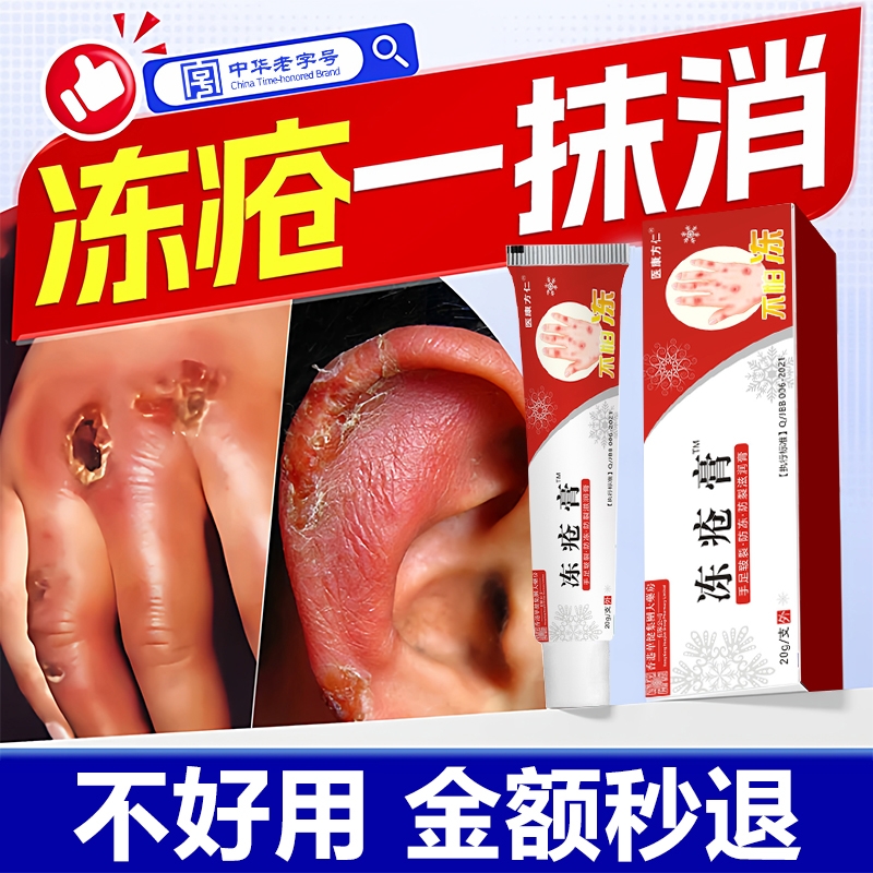 冻疮膏止痒冻伤膏正品防冻排行榜第一名官方旗舰店