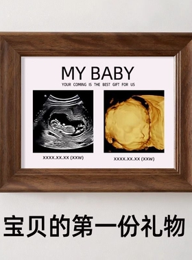 四维照片相框孕期胎儿ntB超彩超