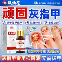 鳳仙花灰指甲抑菌液同專用瑞腳趾灰甲凈增厚修復(fù)灰趾膏藥貼非治療