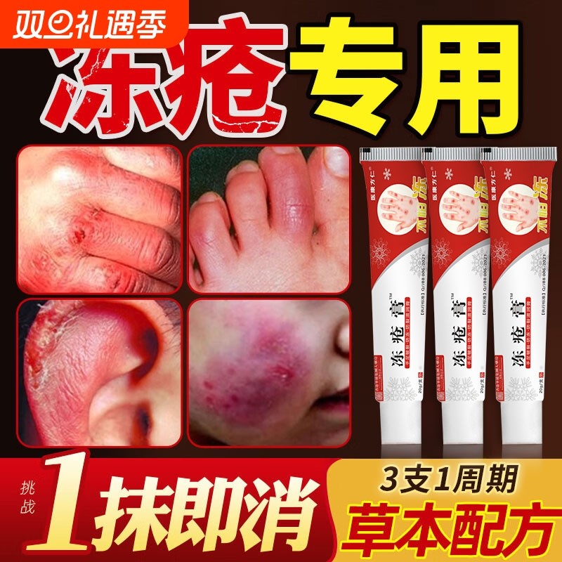 冻疮膏止痒冻伤膏正品官方旗舰店儿童耳朵手指脸部冻伤皮肤护理