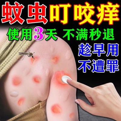 毒虫臭虫叮咬止痒消肿止痒膏蚊虫蠓虫克星毒蚂蚁红蚂蚁咬伤跳蚤咬