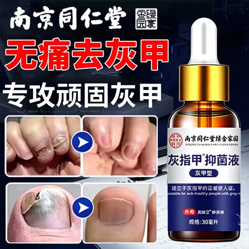 灰指甲脱甲膏软甲膏药贴去除增厚专用旗艦店正品抑菌搽剂
