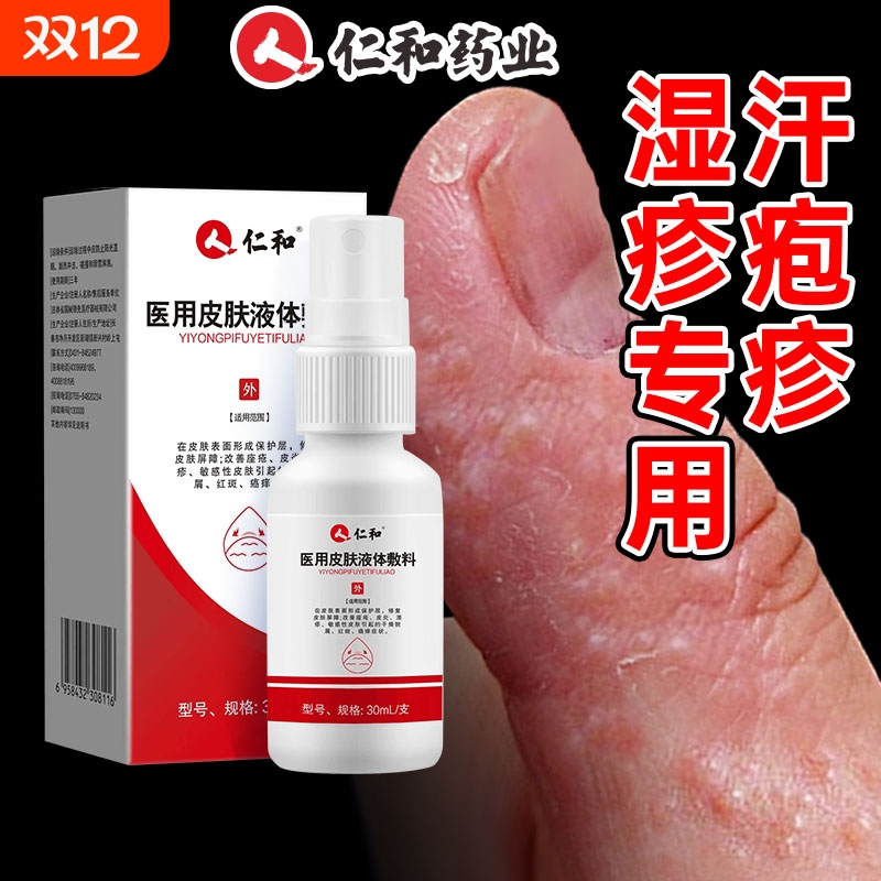 汗泡疱疹汗疱疹湿疹真菌感染正品痱子去手上起小水泡止痒非药膏