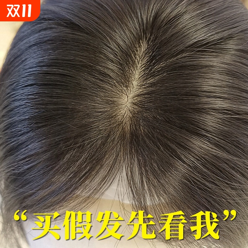 递针假发片女头顶补发片真发全真人发无痕遮白发蓬松增发量假发片
