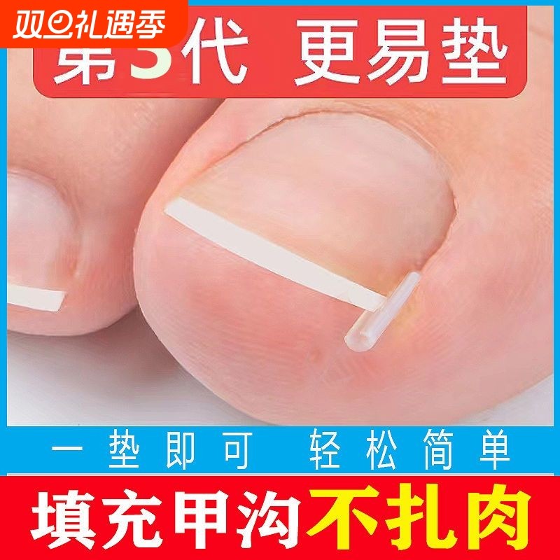 甲沟炎矫正神器指甲嵌甲专用隔离填充垫片脚趾甲往肉纠正甲贴手指