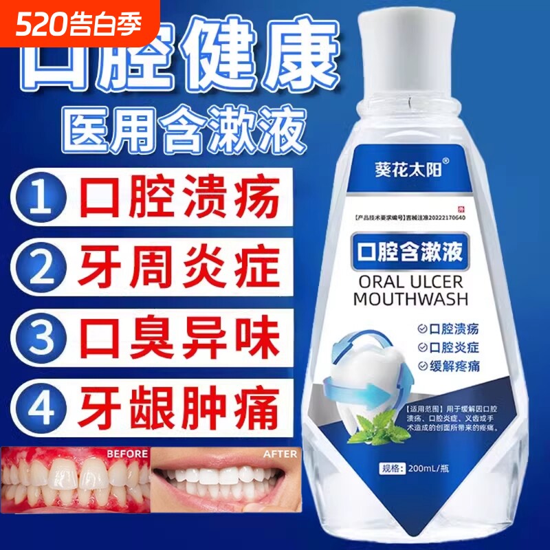 医用漱口水杀菌消炎牙周炎除口臭持久留香溶解口腔溃疡出血抗菌
