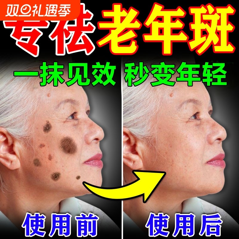 老年斑美白祛斑霜黄褐专用膏药强力去手部除脸部一擦就掉中老年人