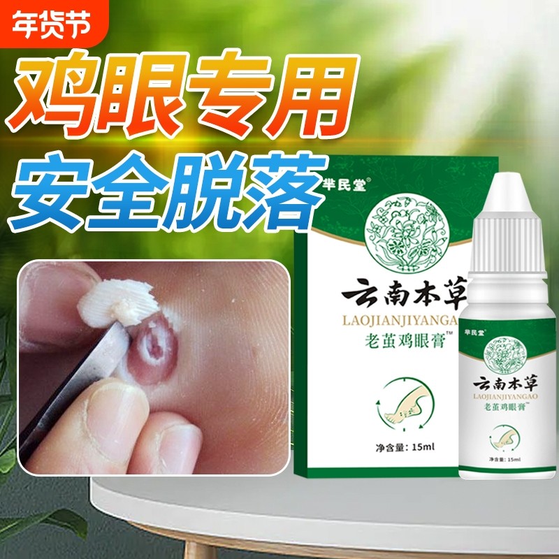 抑菌云南本草老茧鸡眼膏贴鸡眼贴正品去脚底肉刺鸡眼膏去除液草本