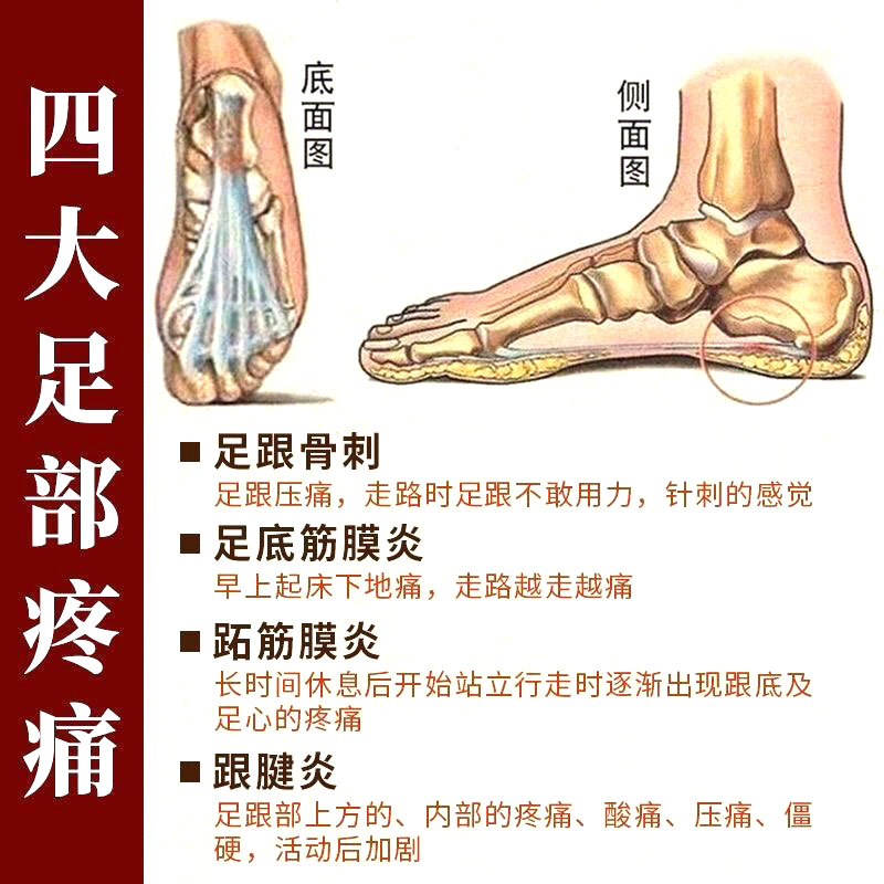 祥草医足跟痛贴脚后跟疼痛足底酸痛跟腱痛专用