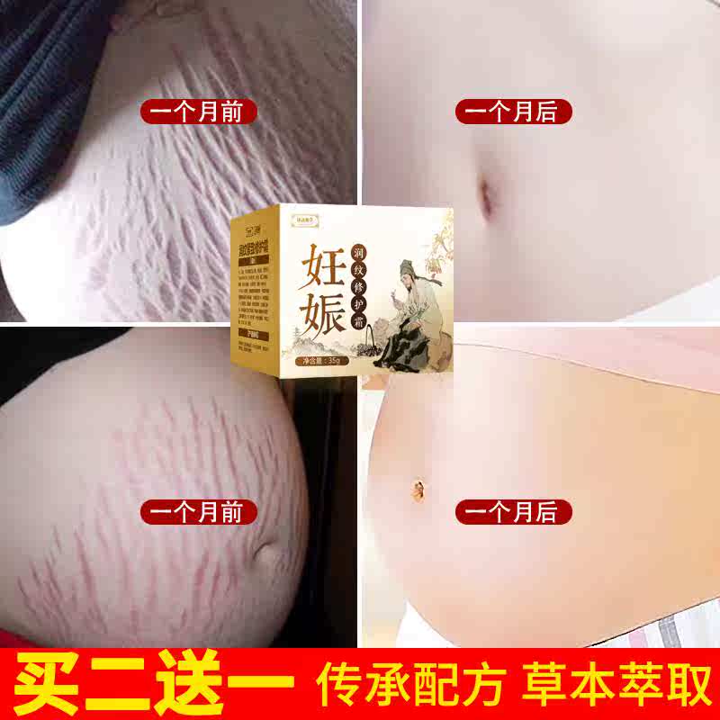 [SimpleXMLElement Object妊娠纹护理]孕妇专用肥胖妊娠仪器修复橄榄油预防产月销量0件仅售165元