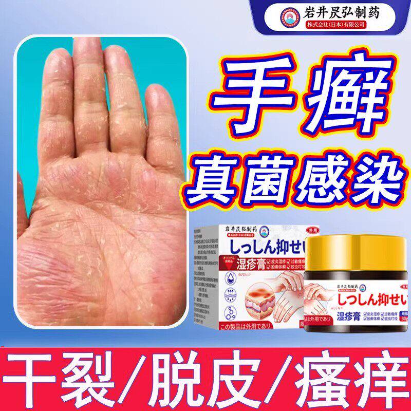 日本进口专治湿毒止痒去皮炎汗疱疹根外用顽固瘙痒止痒药膏