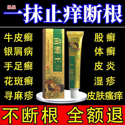 苗癣王医用退热凝胶去湿疹真菌止痒皮炎痤疮癣药膏皮肤过敏瘙痒根