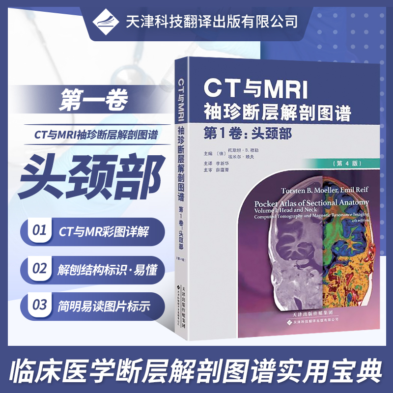 CT与MRI袖珍断层解剖图谱 第1卷 头颈部 头颈部影像诊断学 头影测量 ct读片 医学影像 ct诊断与临床 天津科技翻译出版有限公司