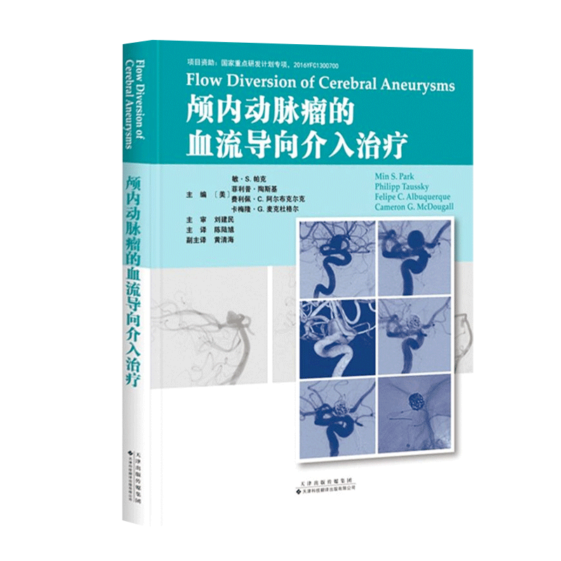 颅内动脉瘤的血流导向介入 治疗治血液分流的起源血液分流理论 基础展开血流装置的操作 方法治疗决策 管理技术选择手术康复书籍