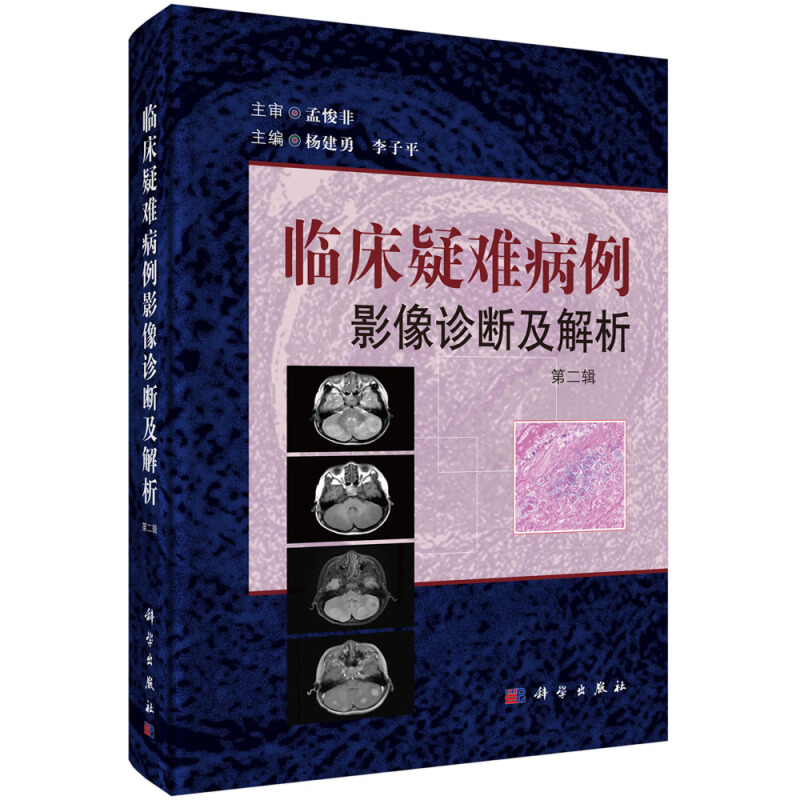 正版临床疑难病例影像诊断及解析(第二辑)杨建勇李子平中枢神经系统头颈五官呼吸系统循环系统体液与免疫系统科学出版社