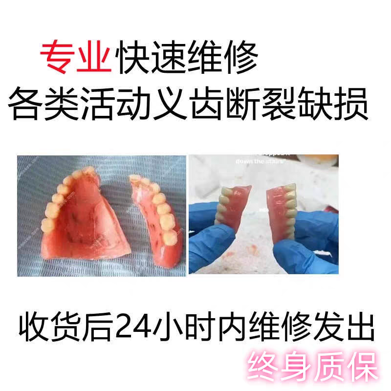 活动义齿维修缺损专业维修义齿断裂缺损钢托排牙维修破损完美修复