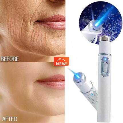 Acne Wrinkle Removal Laser Pen Skin Spots Removal Anti Varic