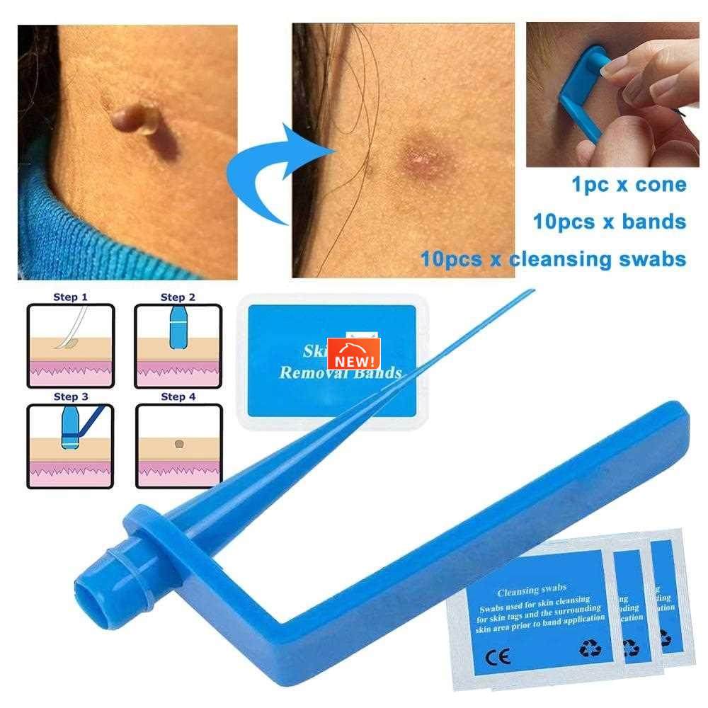 Micro Band Non Toxic Face Care Mole Wart Tool For Small To