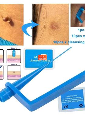 Micro Band Non Toxic Face Care Mole Wart Tool For Small To