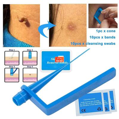 Micro Band Non Toxic Face Care Mole Wart Tool For Small To