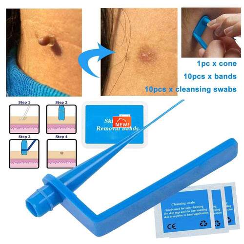 Micro Band Non Toxic Face Care Mole Wart Tool For Small To