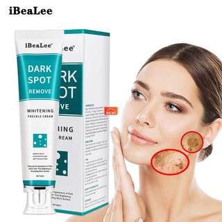 iBeaLee Whitening Freckle Cream Remove Melasma Acne Spot Pig