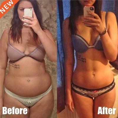 10pcs Weight Slimming Patch Sleep Burning Fat Loss Magnets