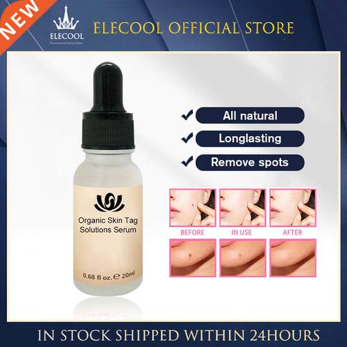Organic Tags Solutions Skin Tag Remover Black Spot Purifyi