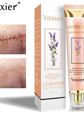 Lavender Scar Repair Cream Repairing Removing Burn Scars Pro