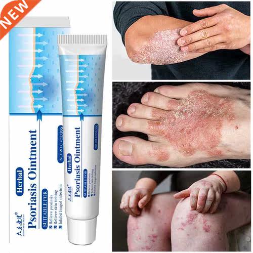 Antbacteral Cream Psorass Ontment Herbal Treatment Fung