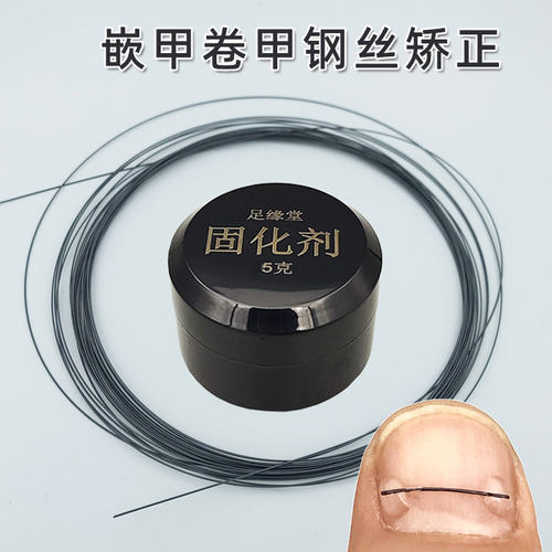 修脚钢丝高弹钛合金嵌甲足缘堂