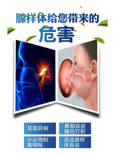 [Дети, посвященные] Железная гипертрофия дети, застой назального, открытый рот, дыхание, храп зубов, выступающий JZ