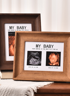宝宝四维彩超NTB超照片打印孕期婴儿出生礼物定制相框纪念照摆台