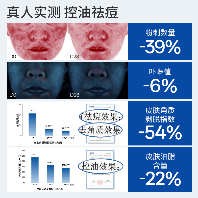 希睿达水杨酸面膜控油祛痘