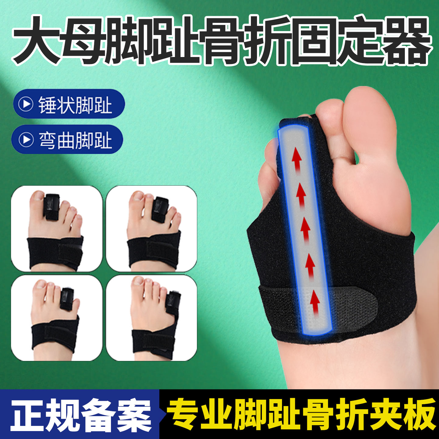 大母脚趾骨折固定器夹板保护脚趾套拇指扭伤弯曲变形小脚趾受伤