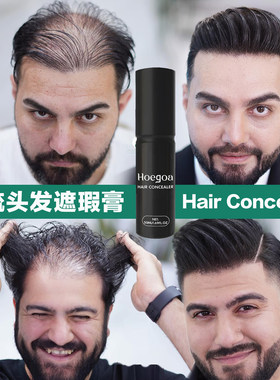 快速增发际线遮盖填补稀疏头发