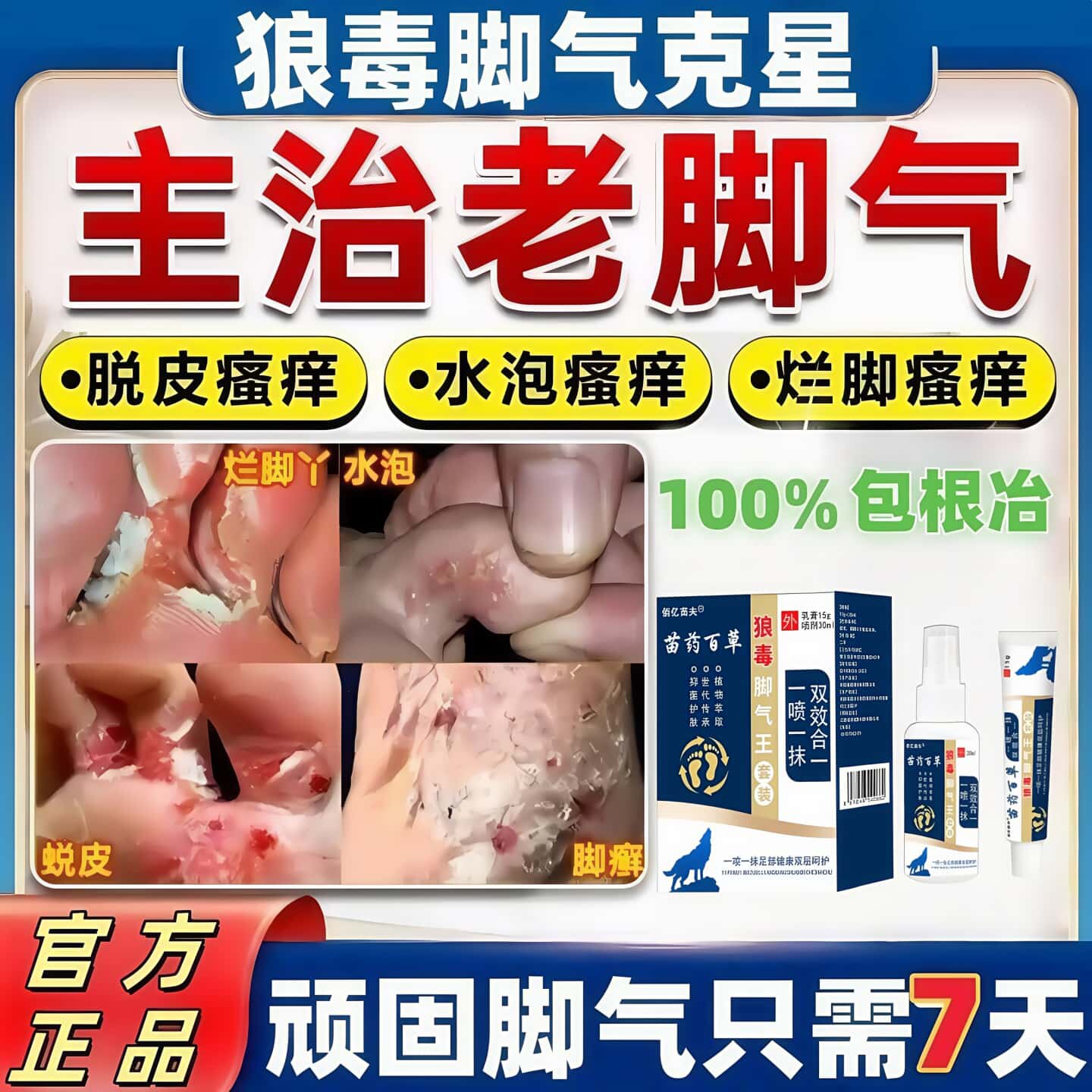 һ���� ���+��ࡾ��1�ס���΢ ��������ֹ����Ƥɱ��ר�ø���ų��������Ⱦ��Чȥ���ý�Ѿ��ҩ