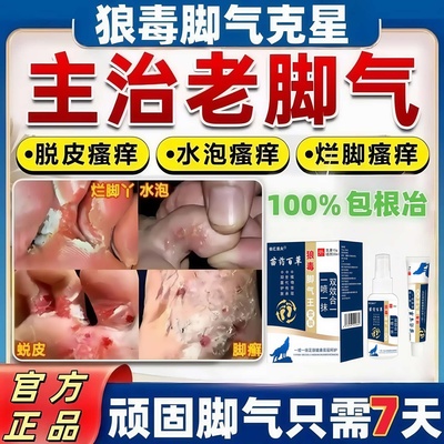 脚气喷雾止痒脱皮杀菌外专用膏臭脚出汗真菌感染特效去糜烂脚根药