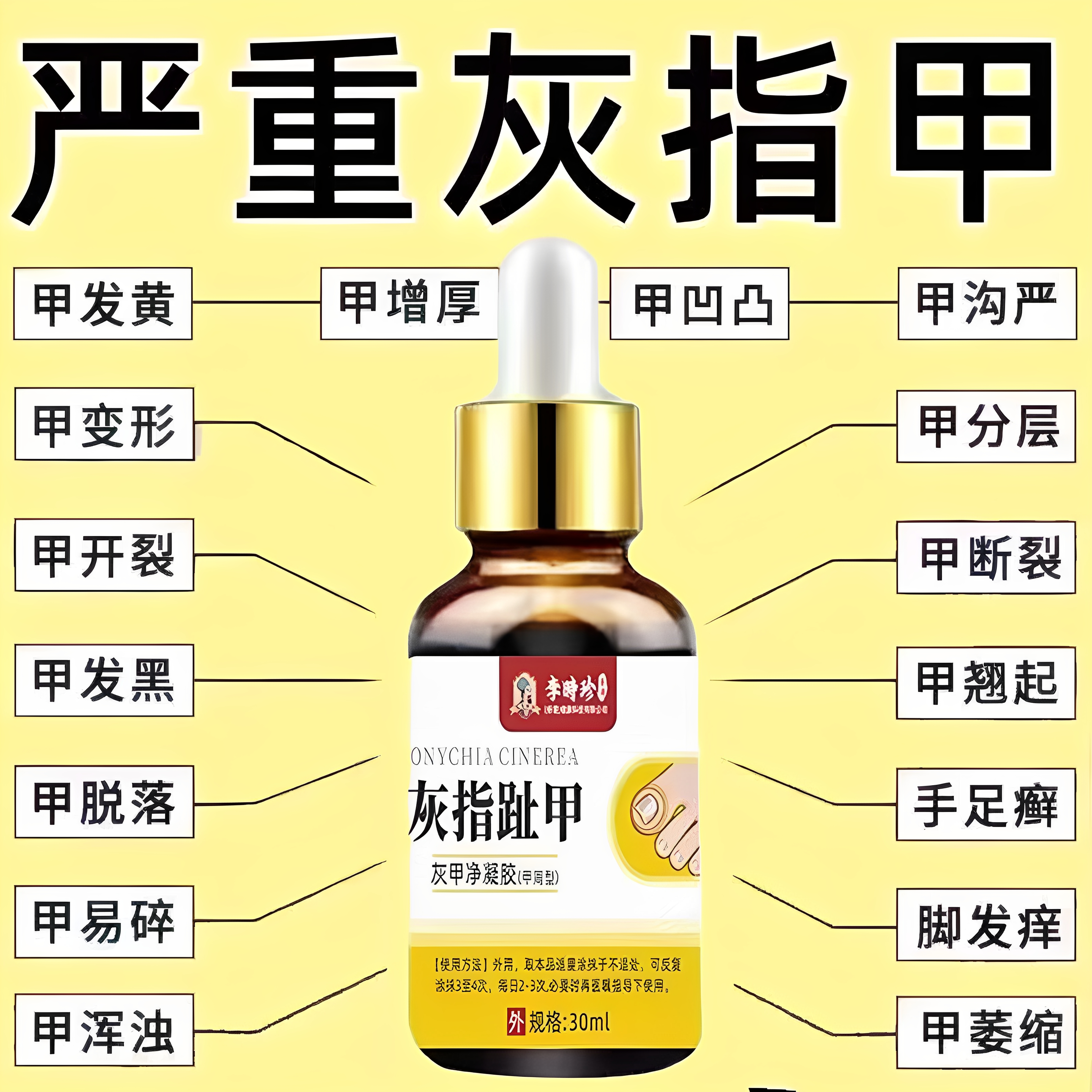 灰指甲甲沟炎抑菌液修复液脱甲软甲膏无痛去脚趾甲软化剂灰甲净