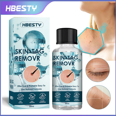 HBESTY 跨境祛wart液 尖锐丝状wart立净 草本净去瘊子克wart液