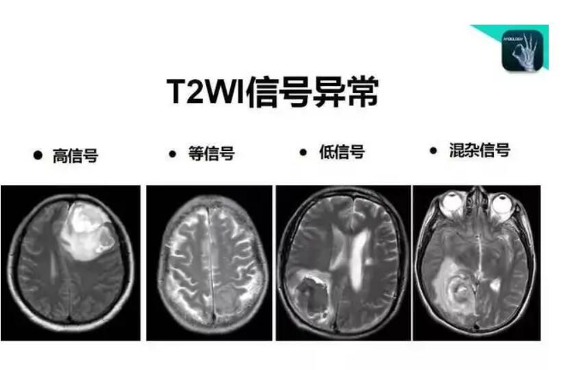 影像读片班一期二期完整手把手天天教你读懂 MRI CT X线视频 商务/设计服务 设计素材/源文件 原图主图