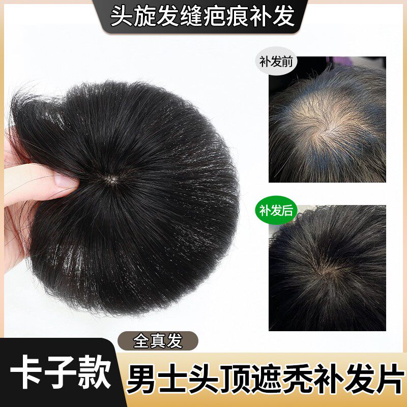 假发片男全真发头顶头旋发缝疤痕补发片递针旋遮脱发男士假发