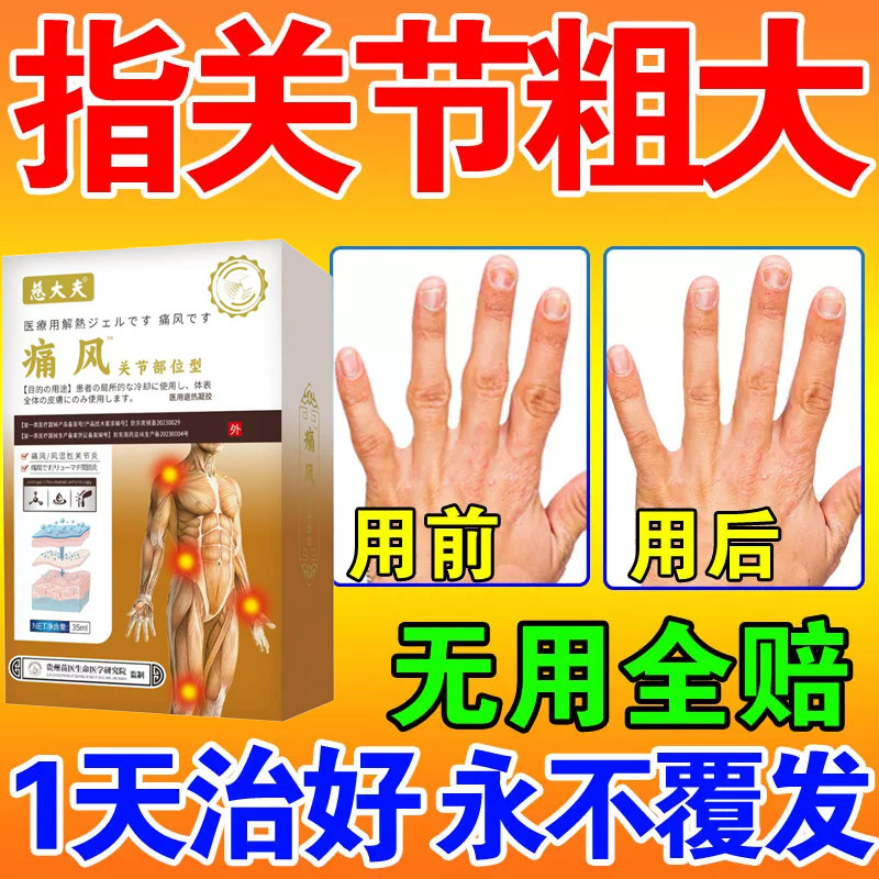 双氯芬酸钠缓释片扶他林75关节炎贴膏药膏手指骨关节炎专用膏药
