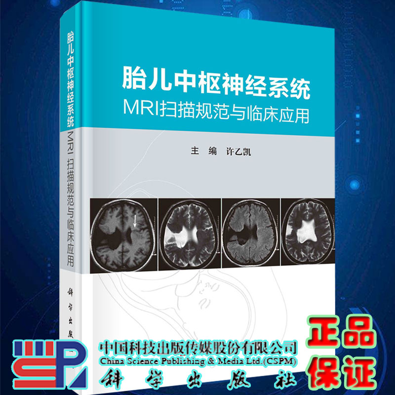 胎儿中枢神经系统MRI扫描规范与临床应用主编许乙凯科学出版社9787030684813