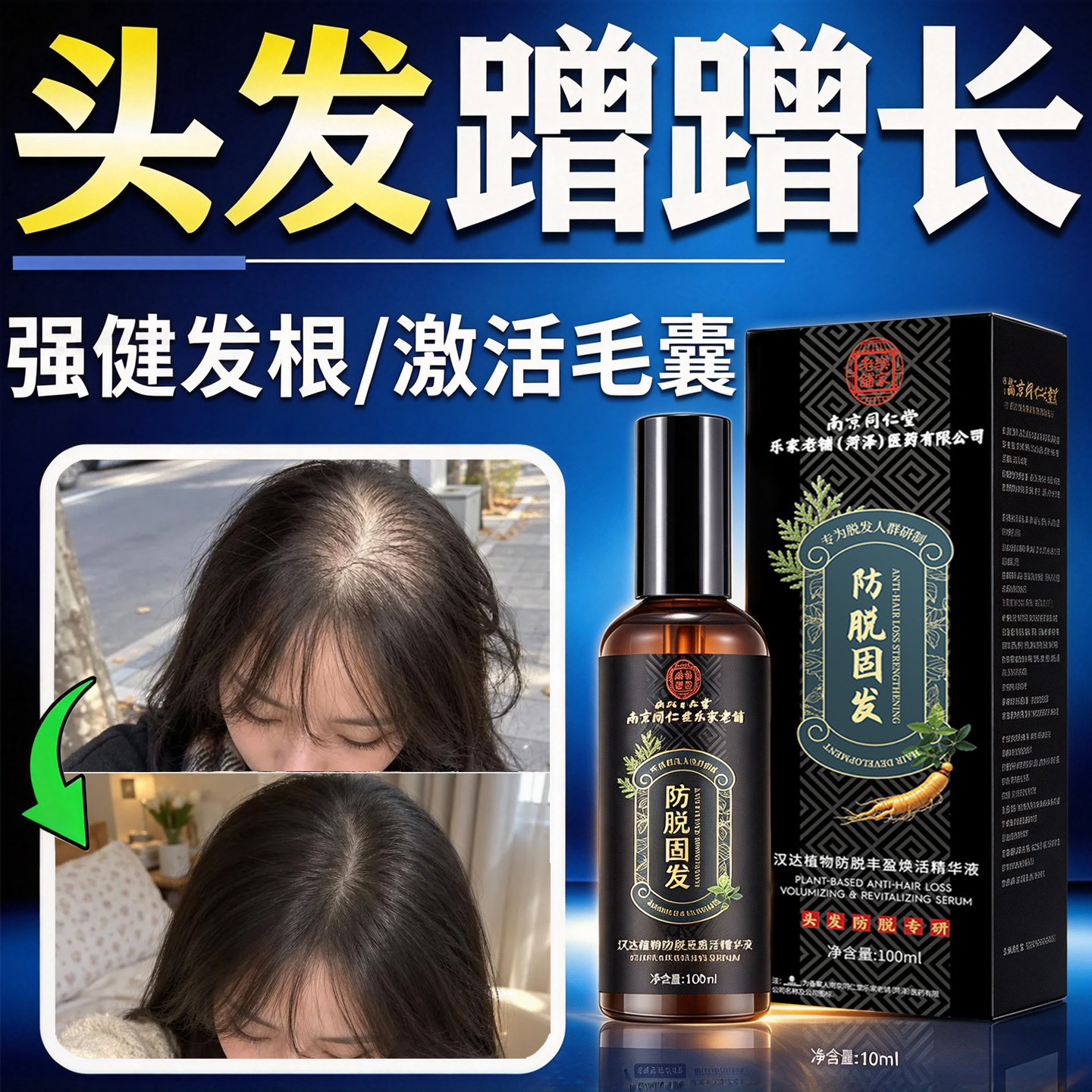南京同仁堂防脱固发精华液快速增长生增发密发剂男女生长头发际线