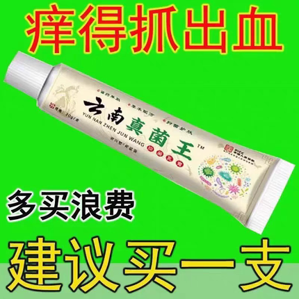正品云南真菌王特效止痒止痒膏快速止痒皮肤外用全身干痒止痒膏