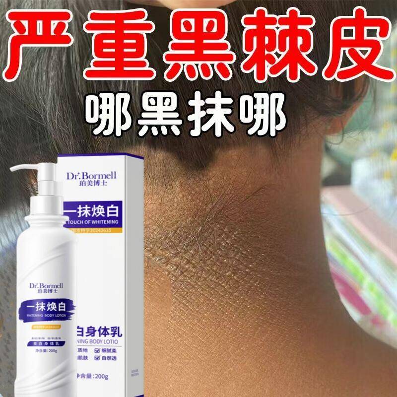 腋下去黑美白腋窝除黑色素沉淀淡化大腿内侧男女生黑脖子沉着淡化