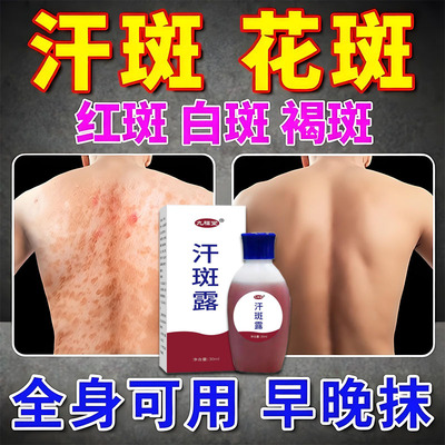 九福堂汗斑露腋下汗多后背手臂肩膀小白点全身皮肤可用汗斑净